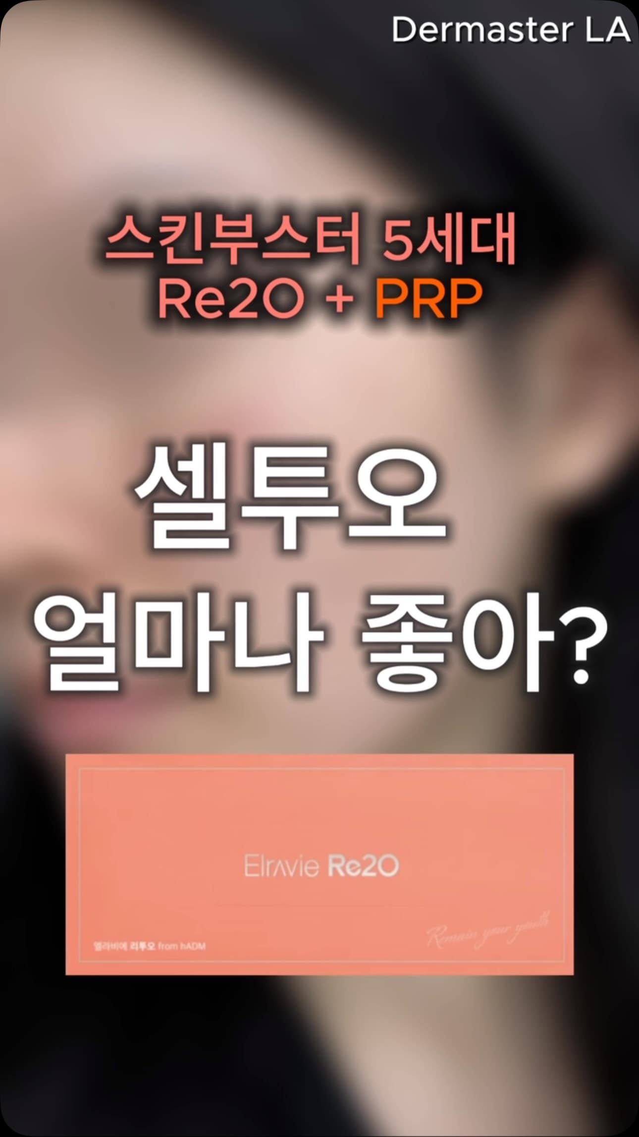 Instagram post: CELL2O: Re2O + PRP