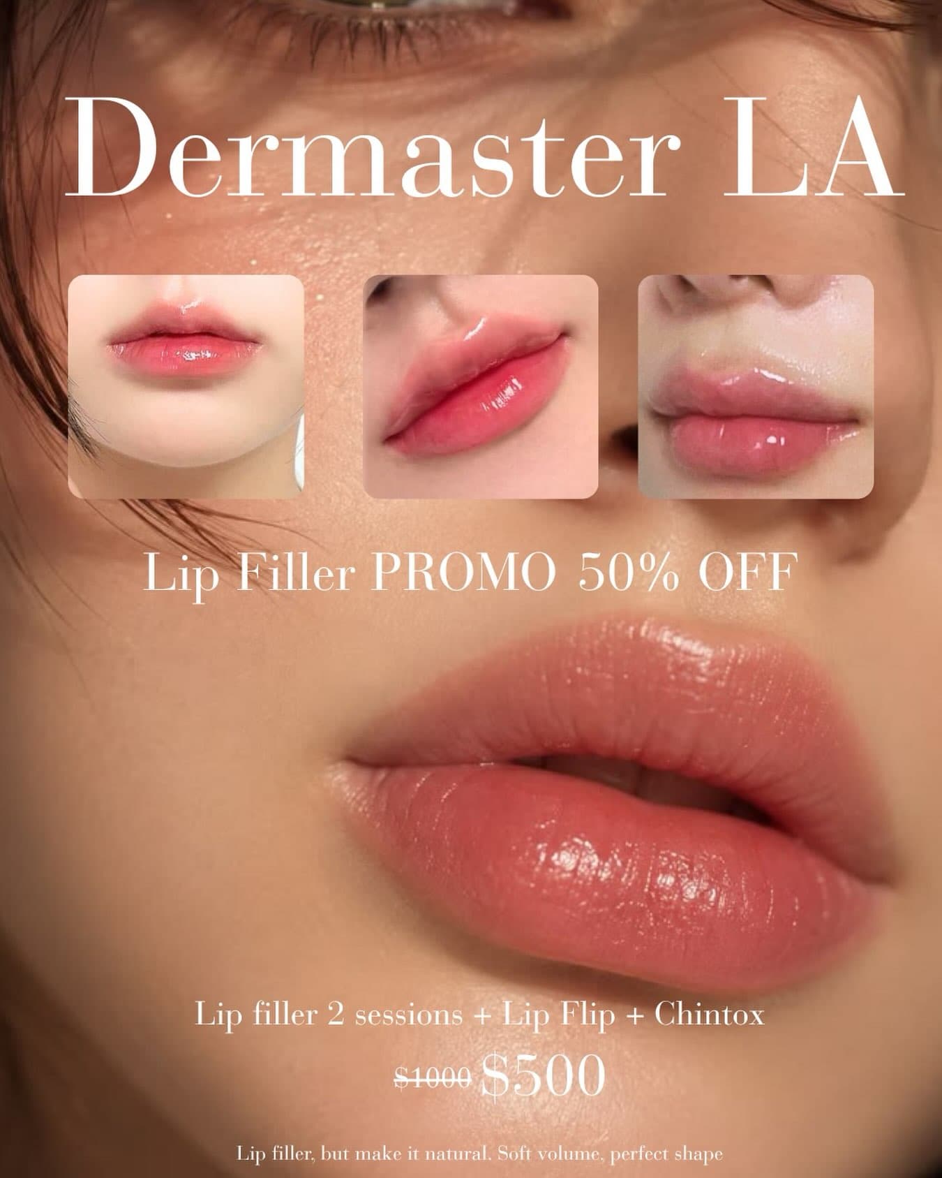 Instagram post: Your lips, but better.