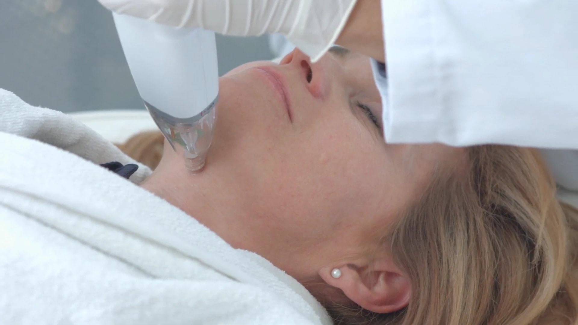The Potenza handpiece on a patient’s cheek, from Jeisys Medical’s film