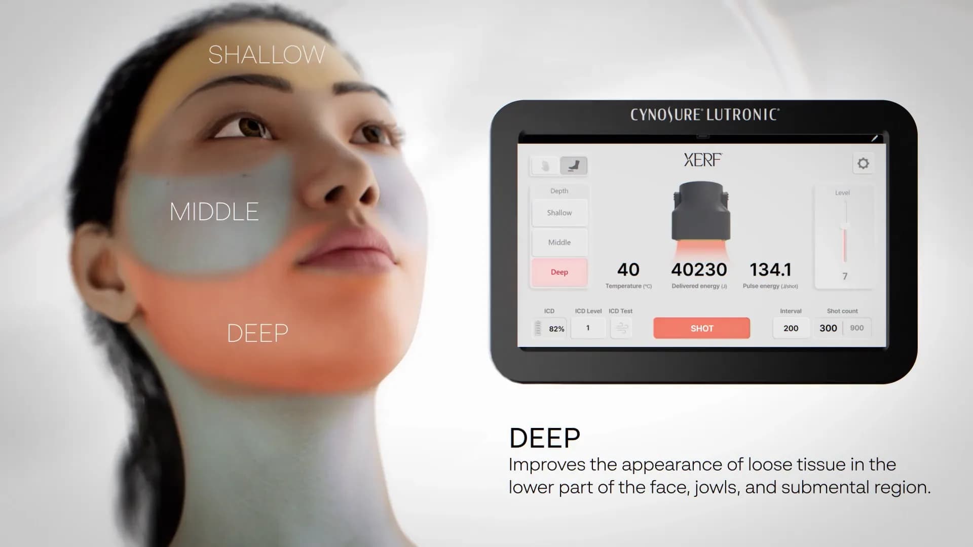The XERF deep depth setting mapped on a model’s face beside the device screen