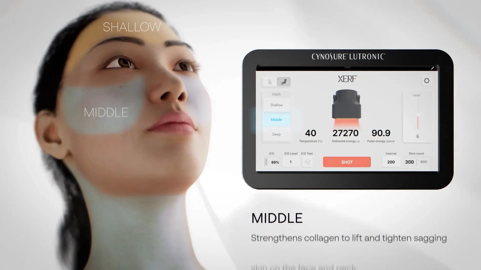 The XERF middle depth setting mapped on a model’s face beside the device screen