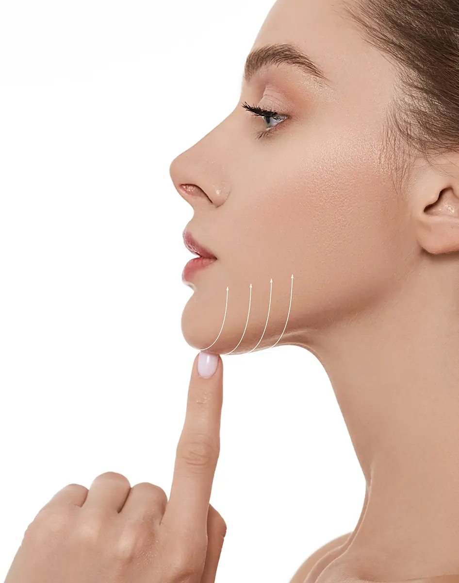 Profile view of a woman with flawless skin, gently touching her chin, with contour lines indicating areas for aesthetic treatment or lifting