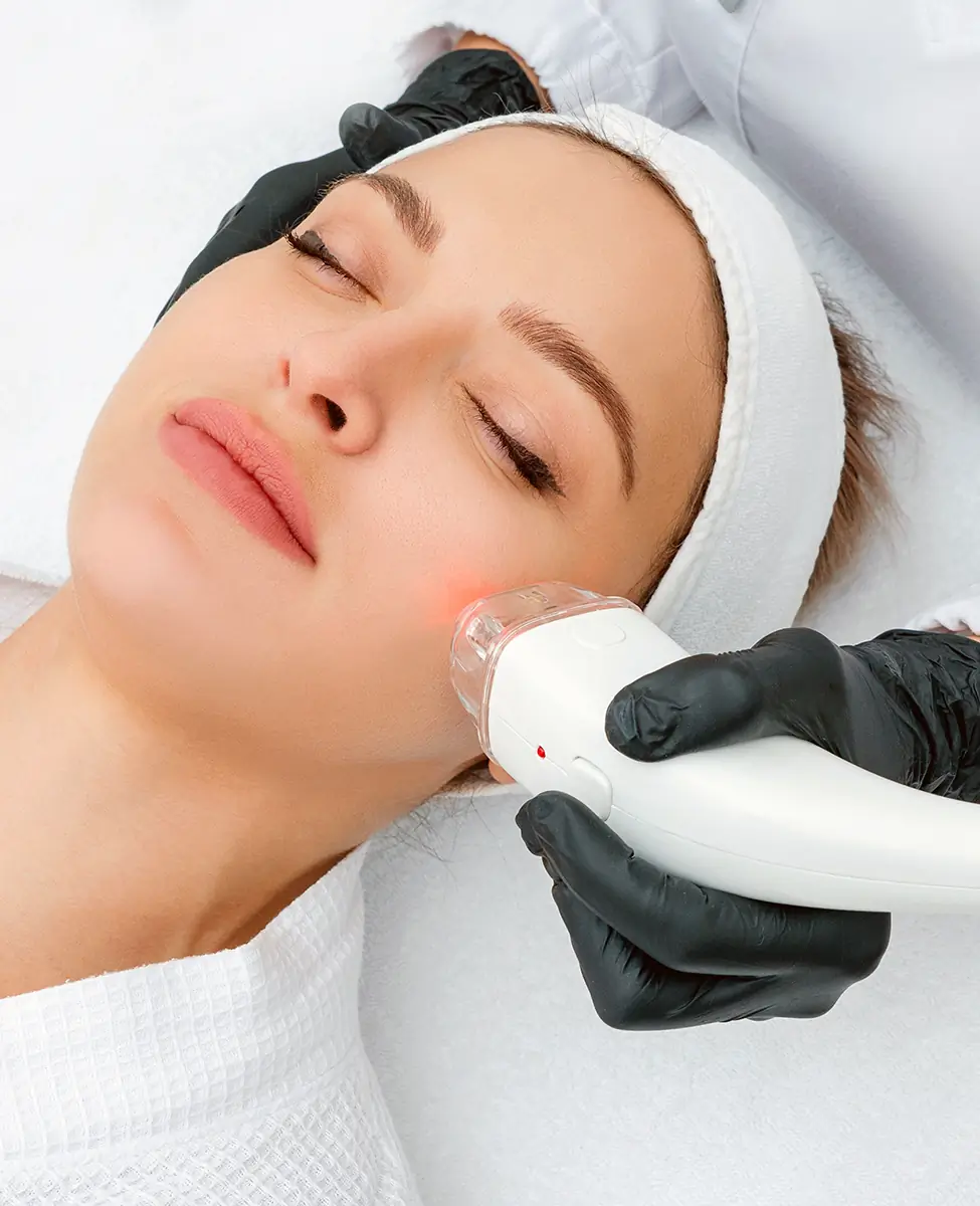 Close-up of a woman receiving laser treatment on her cheek at Dermaster Medical Aesthetic Clinic.