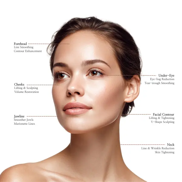 DermasterUSA Radiesse facial map showing treatment zones on a woman’s face—forehead, under-eye tear trough, cheeks, jawline, and neck—for lifting, contouring, and collagen stimulation